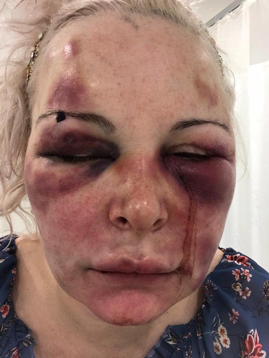 Ataşehir’de Rus kadına otel odasında günlerce işkence edildi