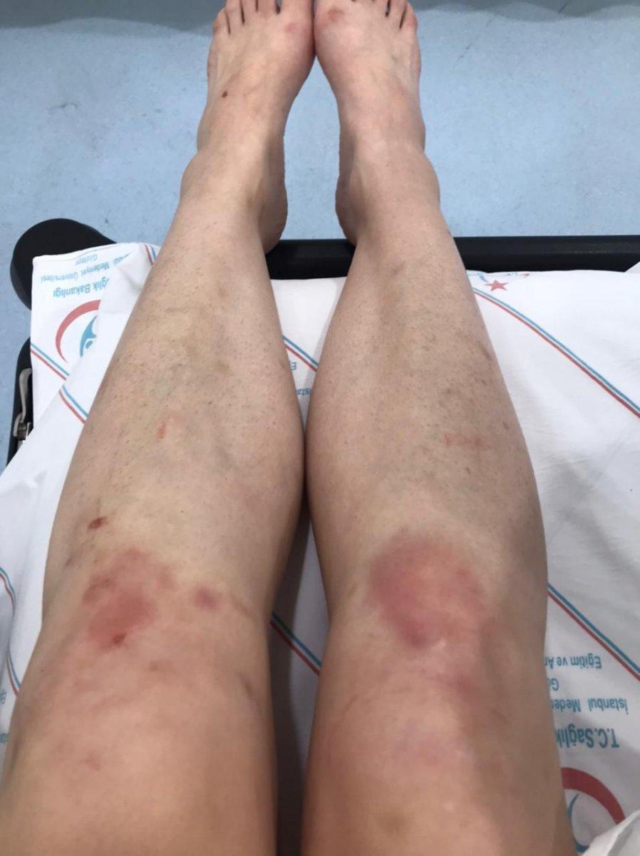 Ataşehir’de Rus kadına otel odasında günlerce işkence edildi