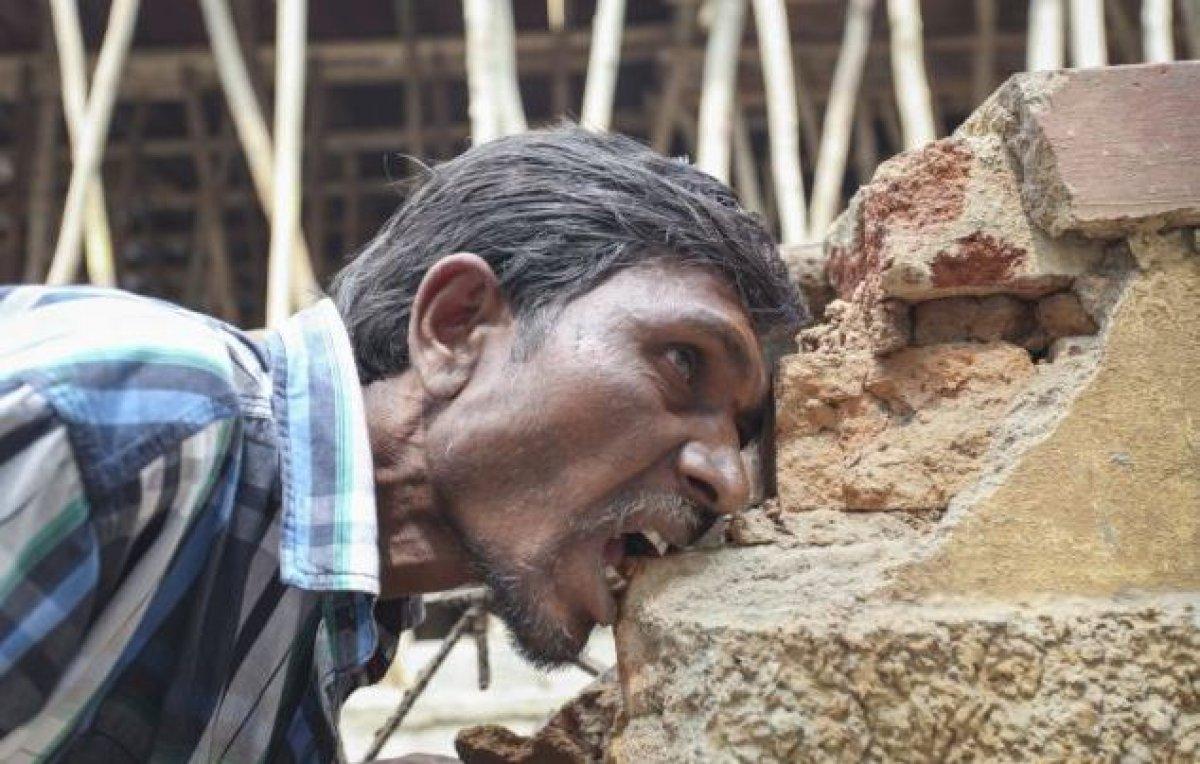 Toprak yeme hastalığı: Pika sendromu nedir?