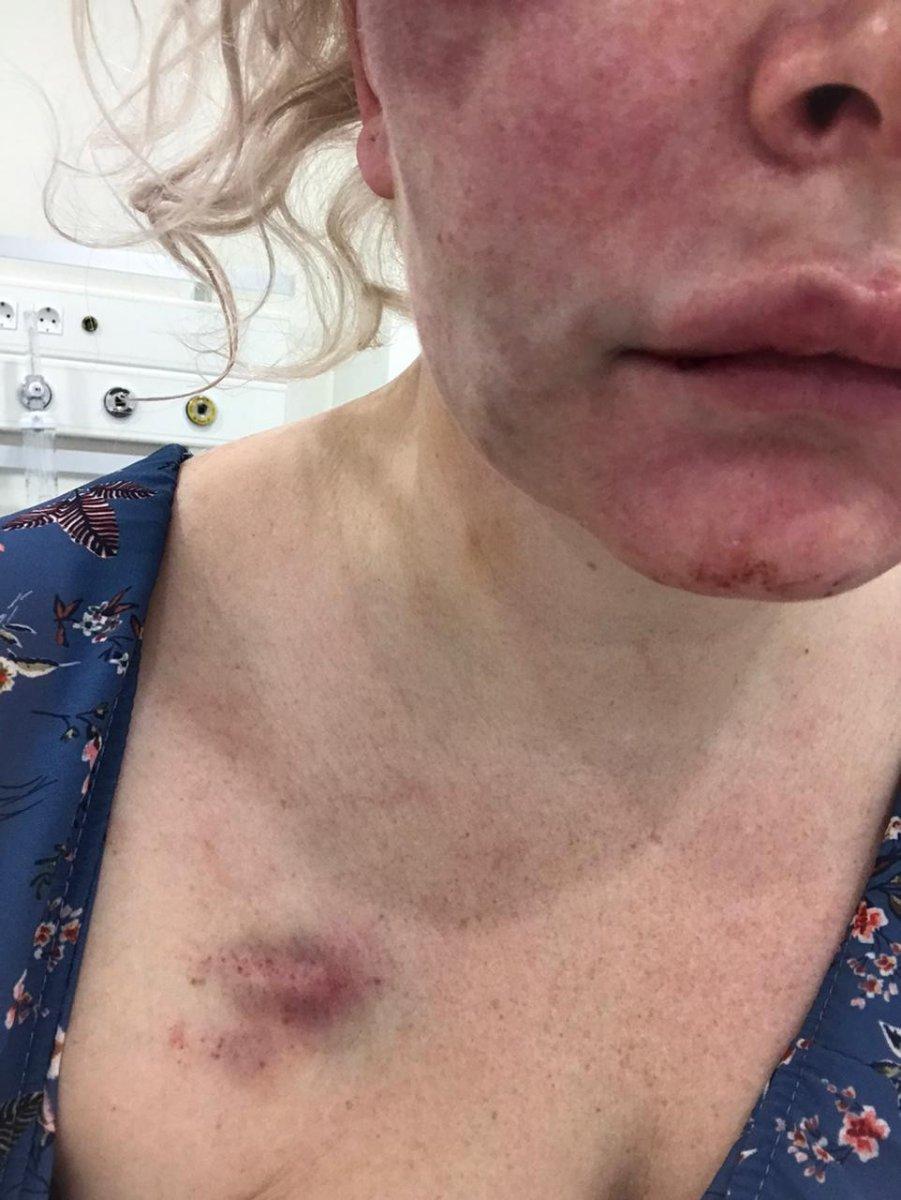 Ataşehir’de Rus kadına otel odasında günlerce işkence edildi