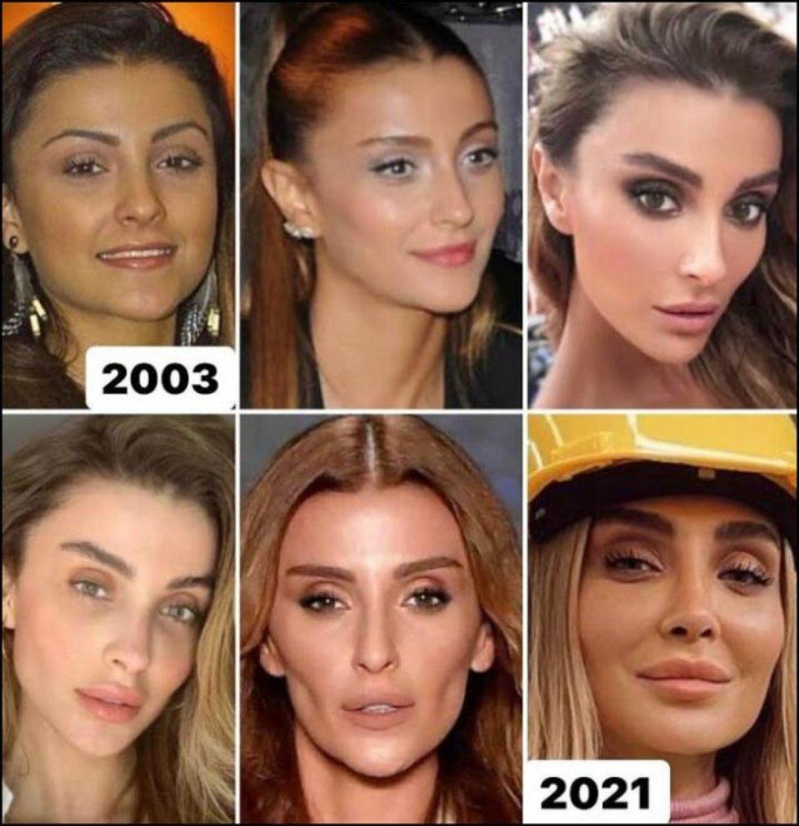 Özge Ulusoy'un kafasına çöp poşeti geçirdiler