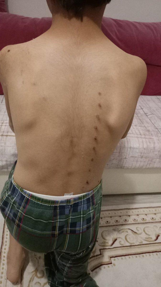 Kütahya’da köpeklerle oynayan 3 çocuğa tırmıkla saldıran hemşire tutuklandı