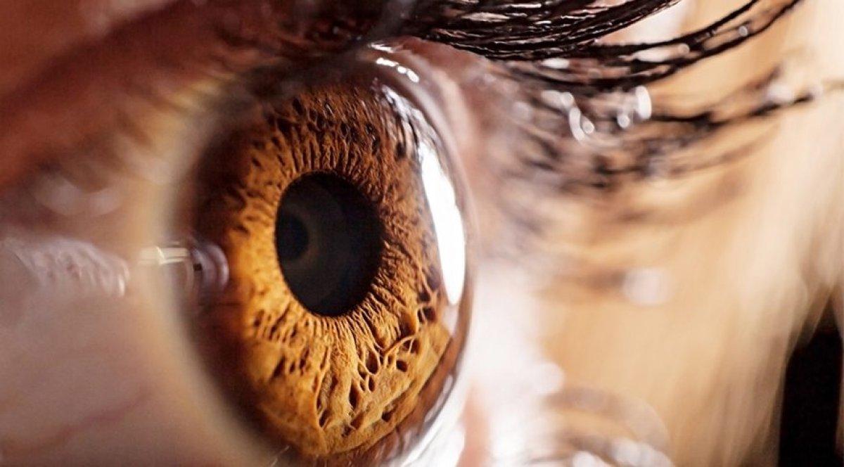 Tavuk Karası nedir, belirtileri nelerdir? Tavuk Karası (Gece körlüğü) tedavi edilir mi?