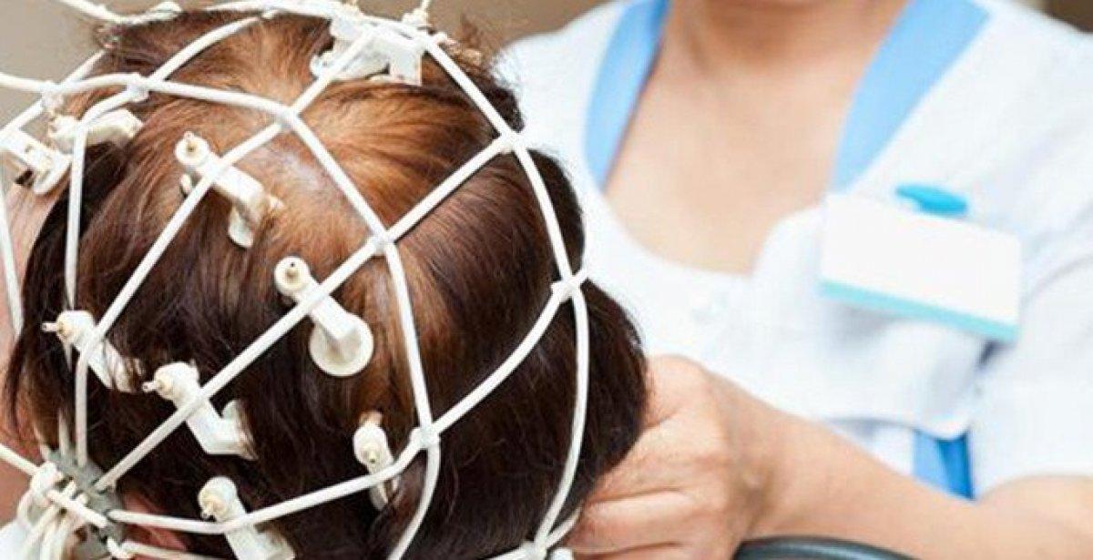 Hafıza sildirme yöntemi: TMS nedir? Trans Manyetik Stimülasyon nasıl yapılır?