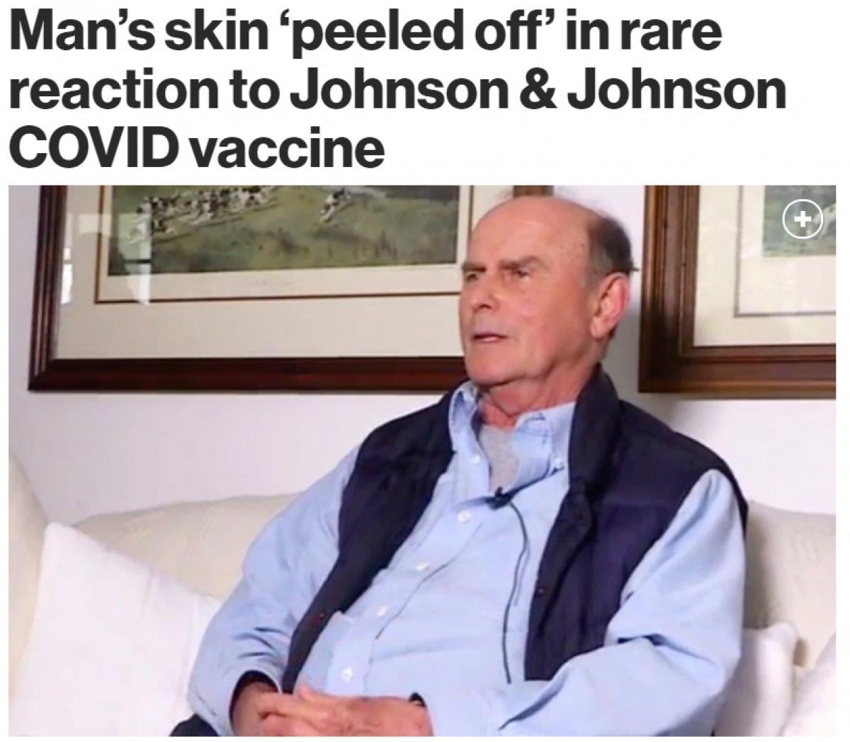 ABD'de koronavirüs aşısı, ciddi yan etkiye neden oldu