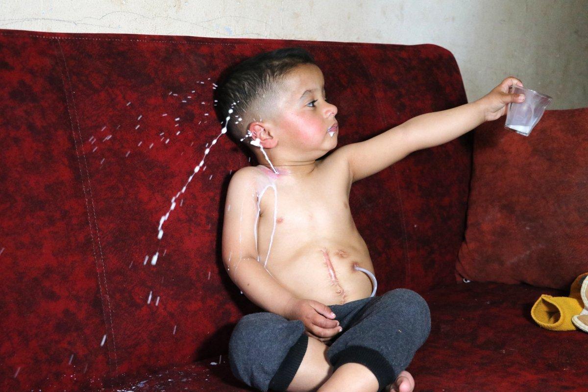 Adana'da yemek borusu olmayan Muhammed yardım bekliyor