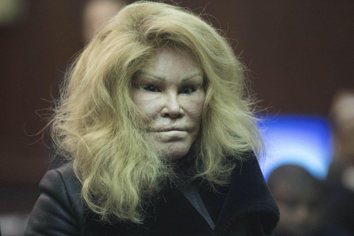 Jocelyn Wildenstei estetik masrafları yüzünden iflas etti