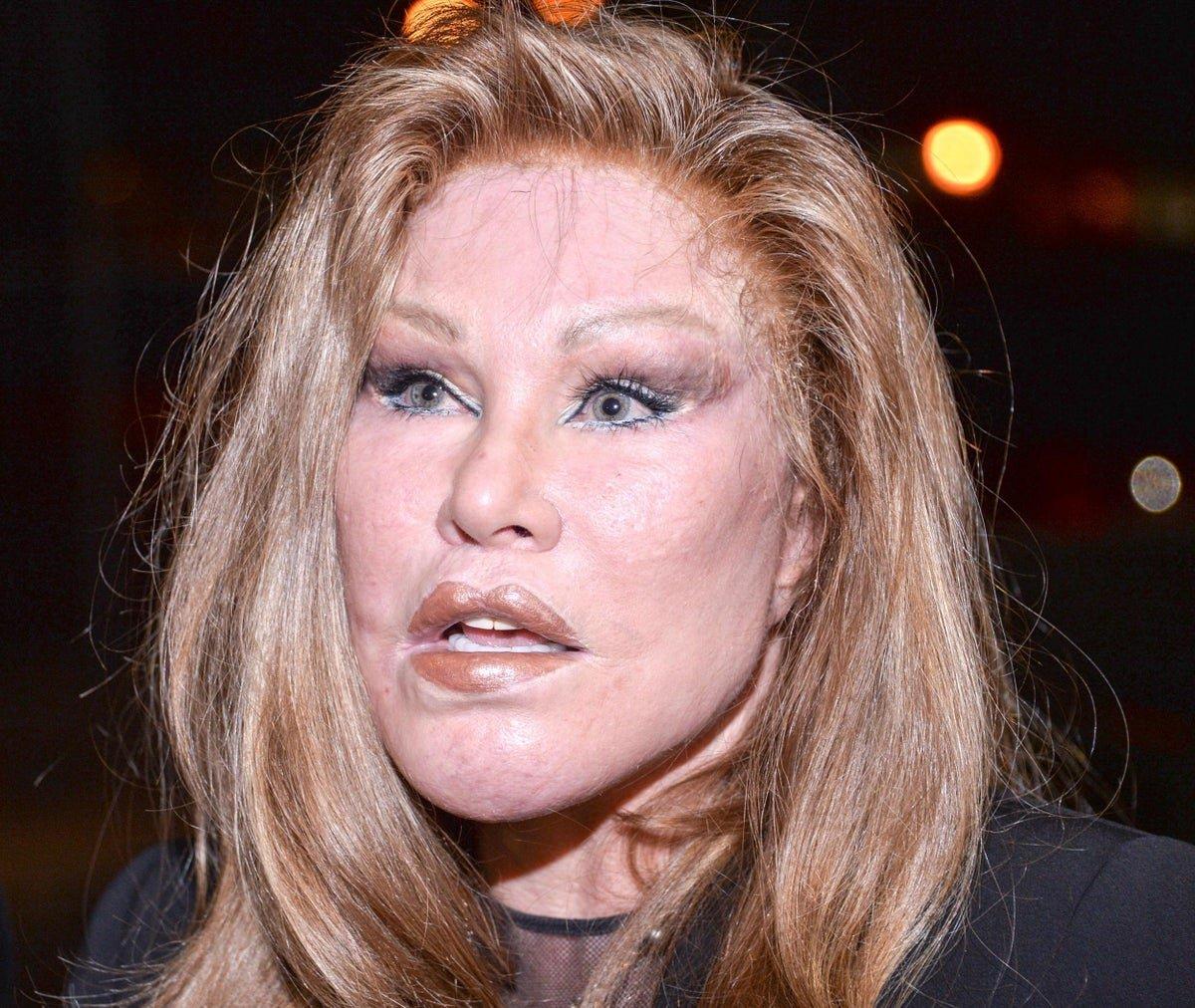 Jocelyn Wildenstei estetik masrafları yüzünden iflas etti