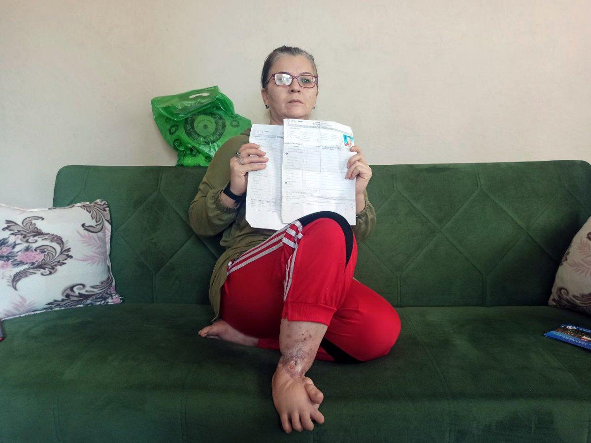 Mersin'de vücuduna iltihap yayılan kadın yardım bekliyor