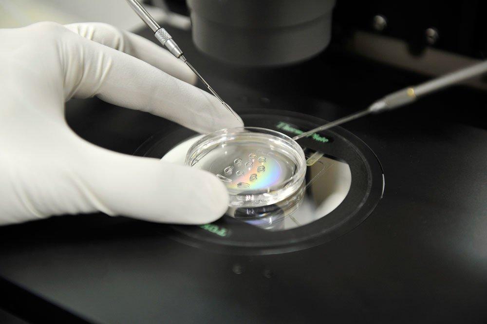 Tüp bebek yönteminde sperm kalitesi büyük önem taşıyor