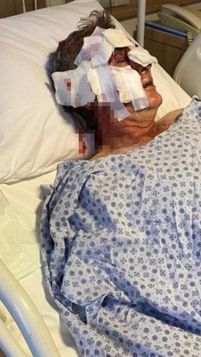 Antalya'da otel çalışanına maymun saldırdı