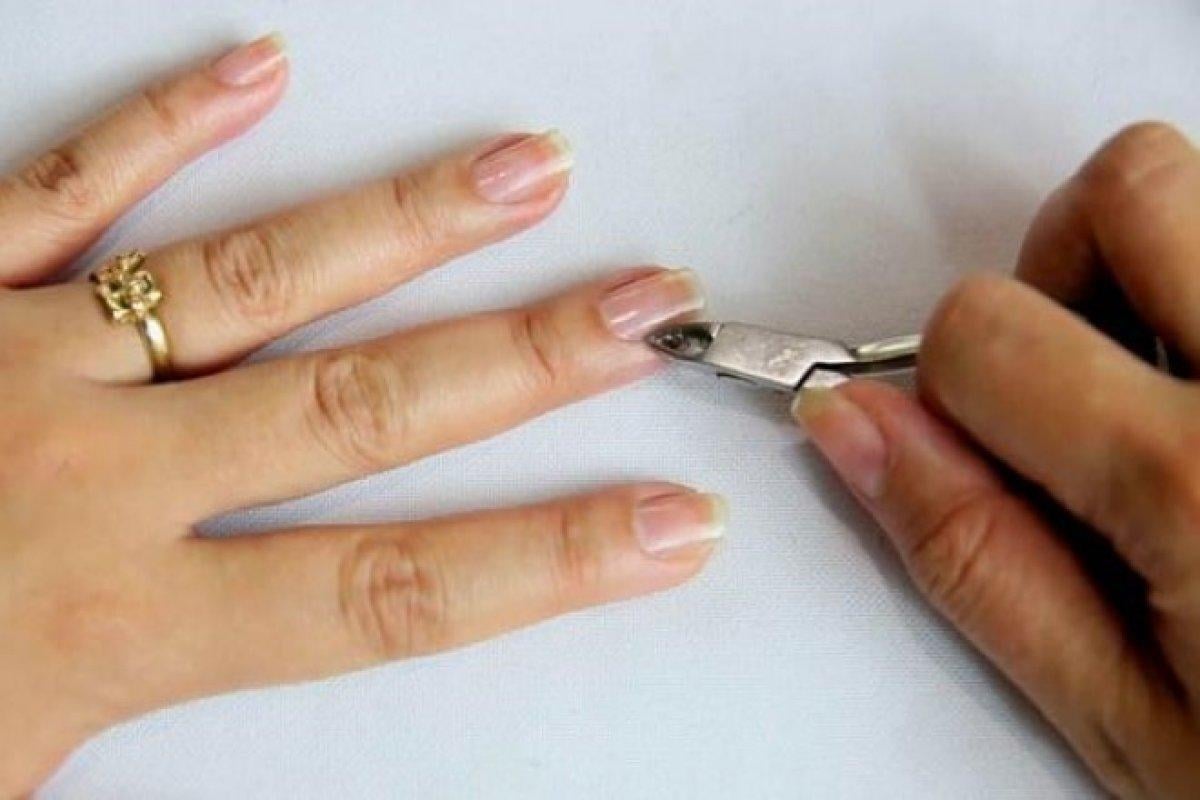 Ellerdeki iltihap riski: Şeytan tırnağı nedir? Şeytan tırnağı neden çıkar?