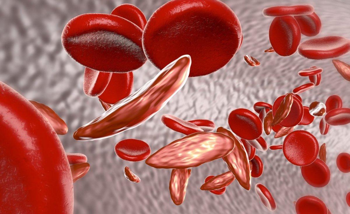 Kalp üfürümünün 8 sessiz belirtisi