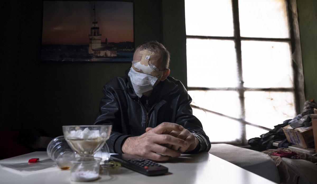 Konya'da cilt kanseri nedeniyle yüzünü kaybetti, hayatı kabusa döndü