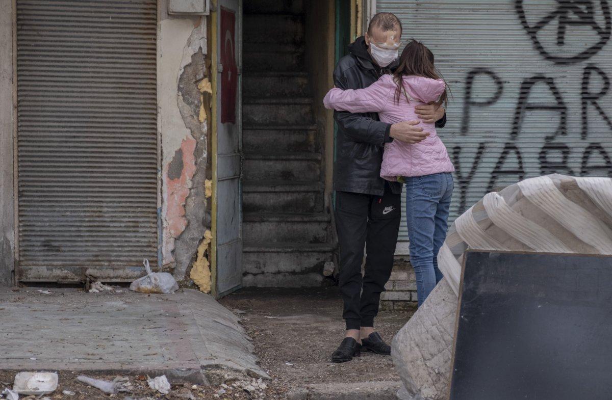 Konya'da cilt kanseri nedeniyle yüzünü kaybetti, hayatı kabusa döndü