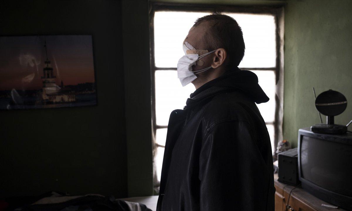 Konya'da cilt kanseri nedeniyle yüzünü kaybetti, hayatı kabusa döndü