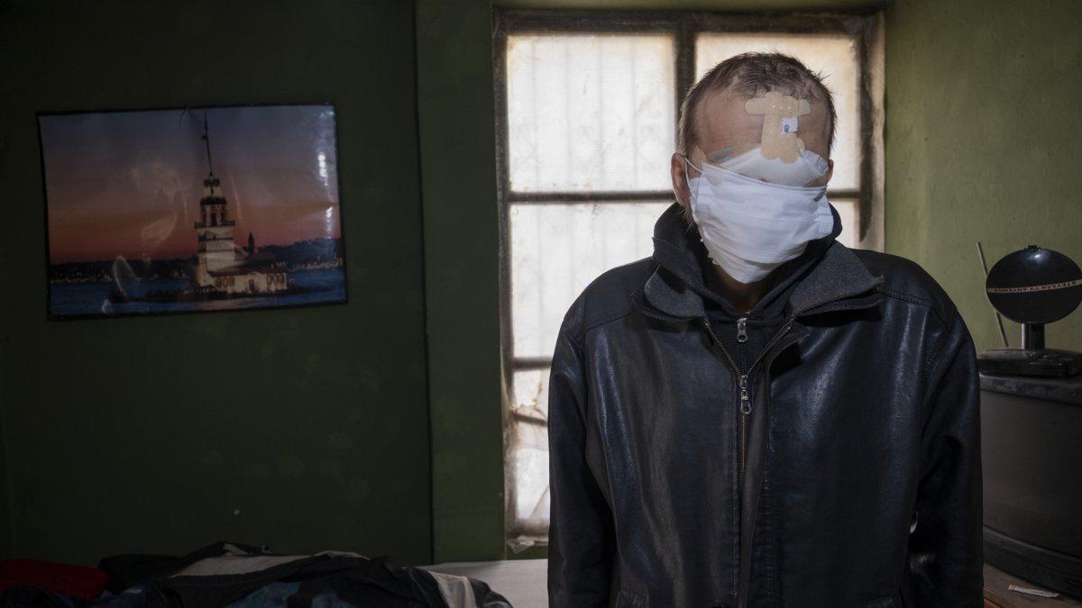 Konya'da cilt kanseri nedeniyle yüzünü kaybetti, hayatı kabusa döndü