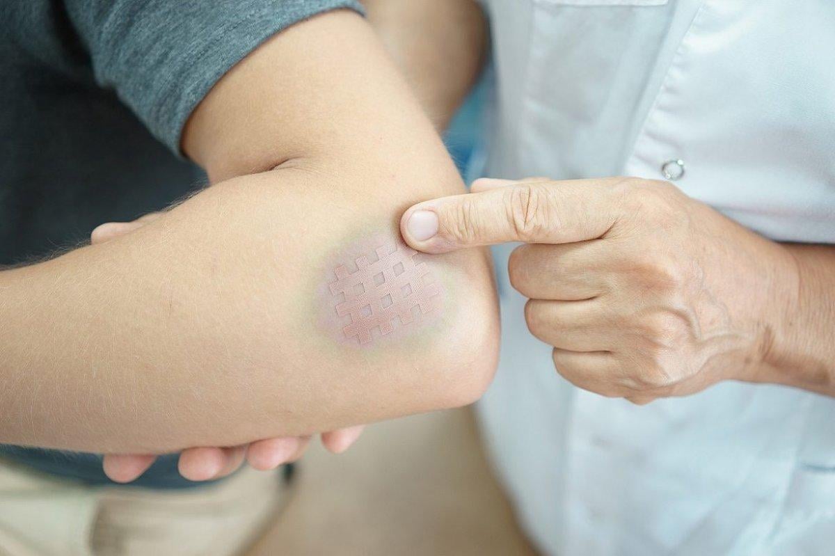 Sinir hasarını gösteren 8 belirti