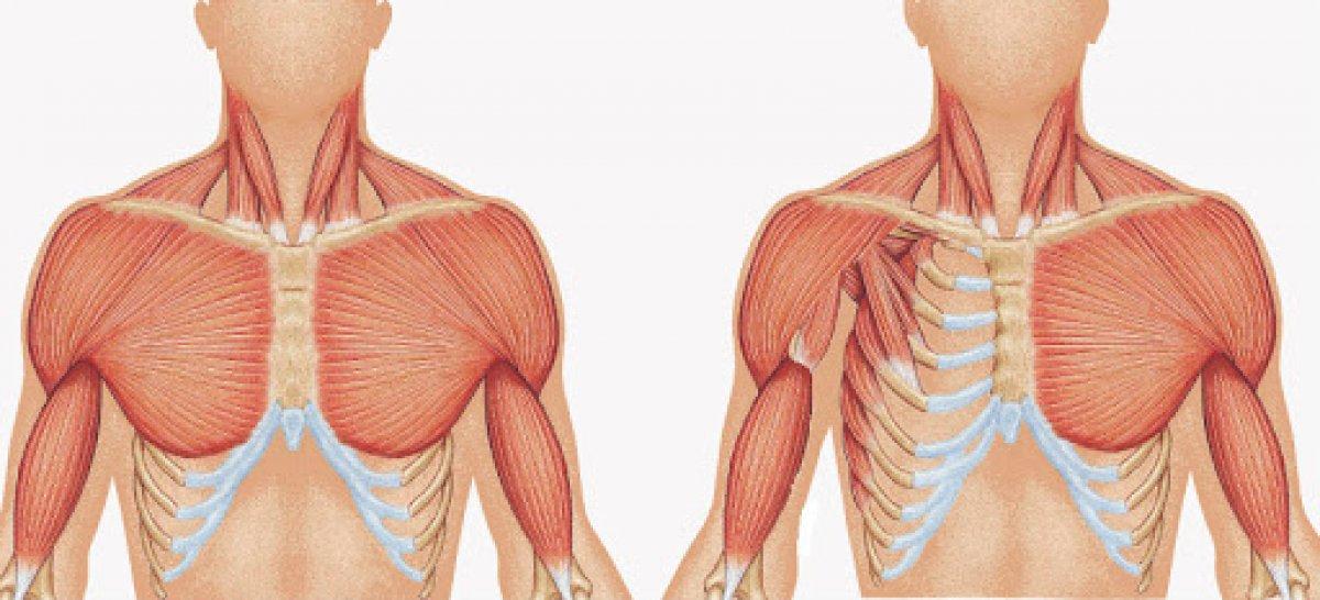 Göğüs duvarının deformitesi: Poland sendromu nedir?
