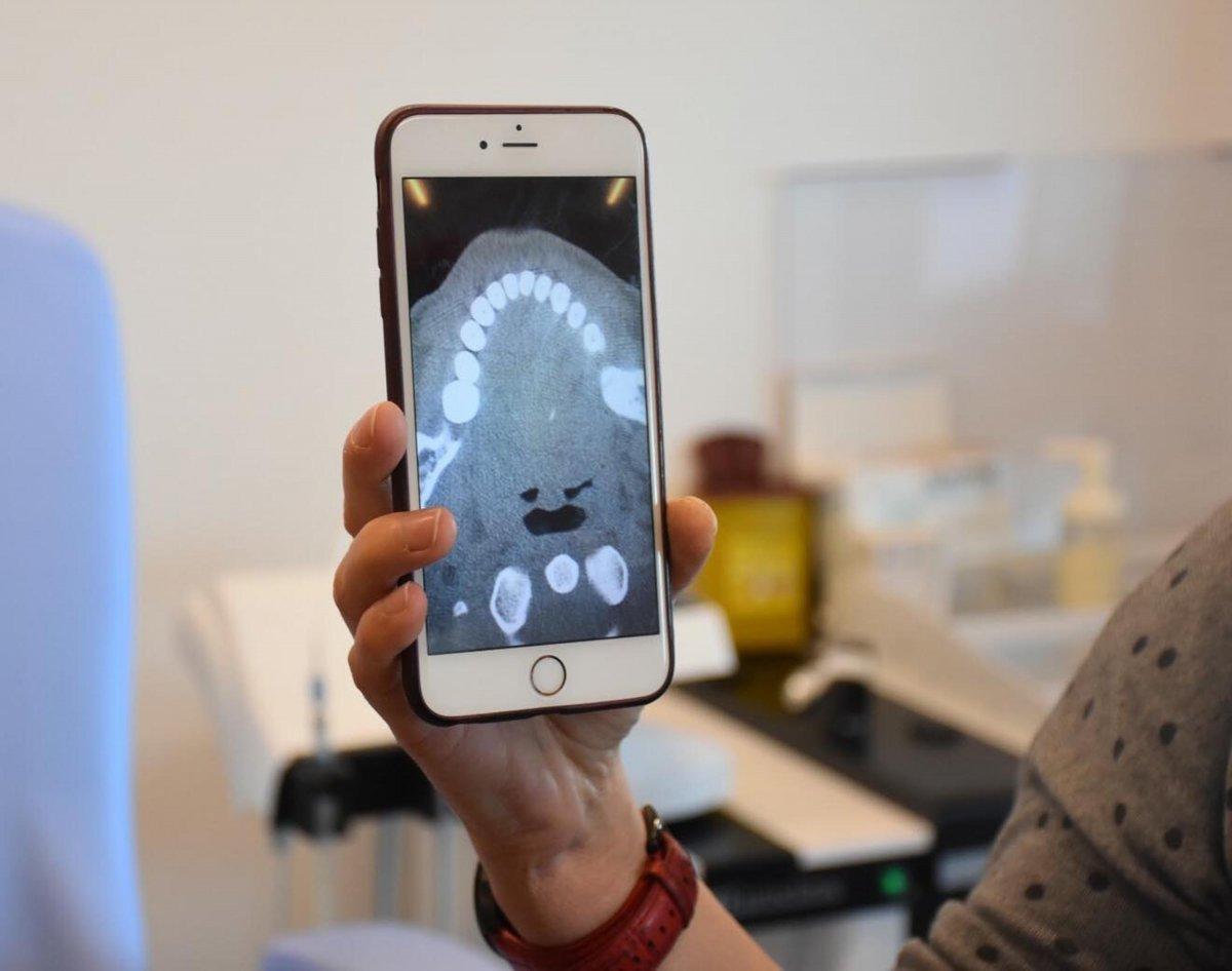 İzmir'de kokoreç yerken diline iğne batan kadın hastaneye koştu