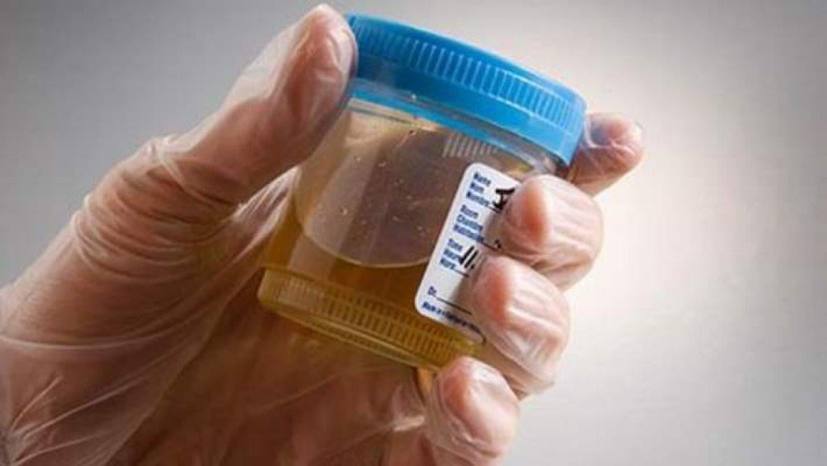 Ağrılı mesane iltihabı: Sistit belirtileri nelerdir? Sistit tedavi yöntemleri