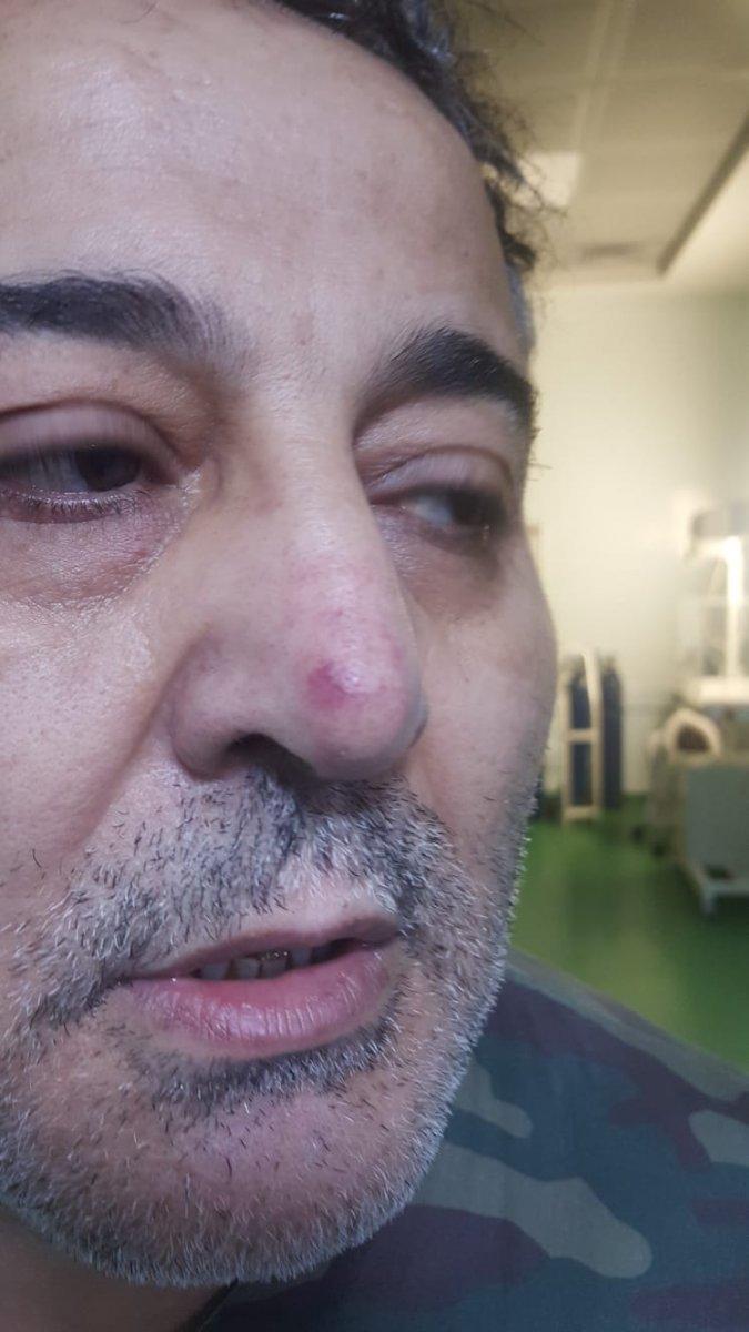 Ordu'da hasta yakını, doktoru darbetti