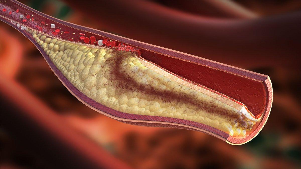 Oruç tutmanın sağlığa 8 faydası
