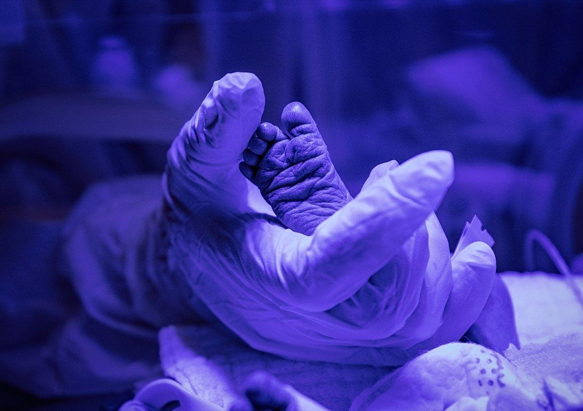 Hasta bebekler, sağlıkçıların şefkatli ellerinde ilgi görüyor