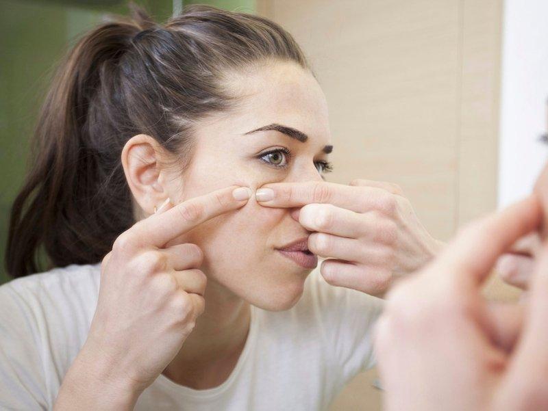 Diyet ve stres akne oluşumuna etki edebiliyor