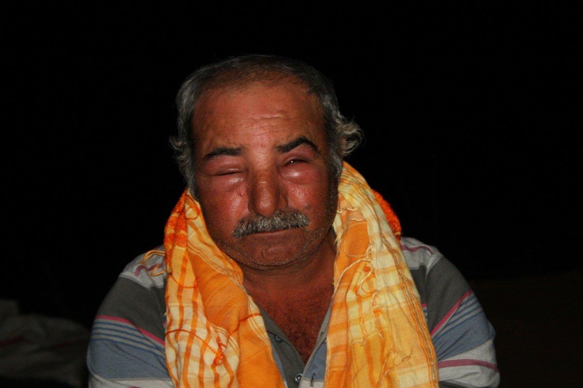 Antalya'da arı saldırısına uğrayan çoban: İnsanlar dışarı çıkamaz oldu