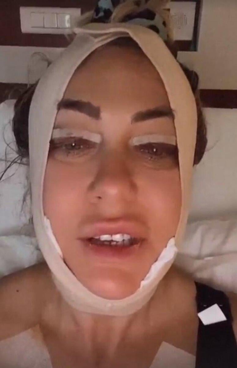 Yeliz Yeşilmen, estetik ameliyatı geçirdi