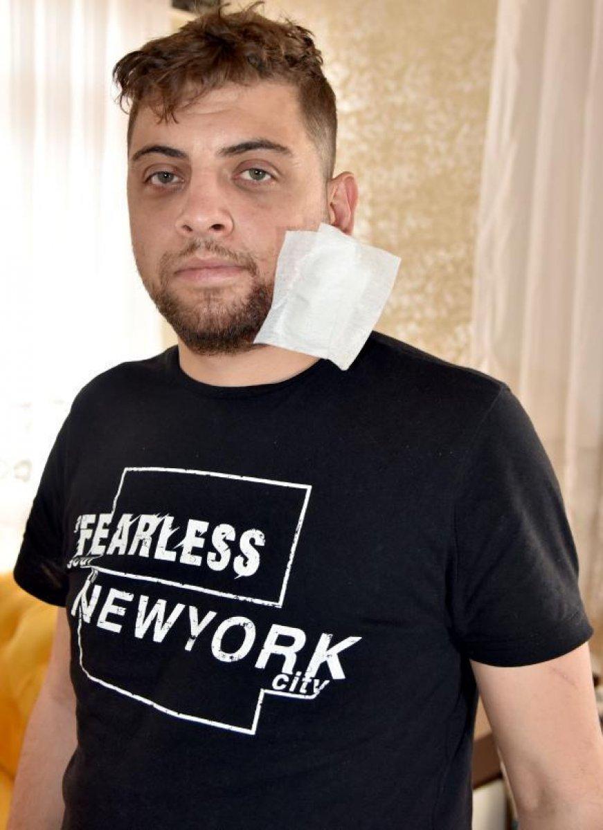 Antalya'da, kız arkadaşını döven şahsa müdahale edince yüzü parçalandı