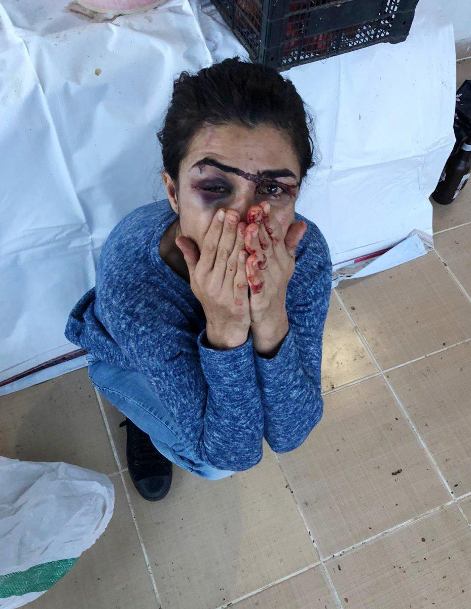 Antalya'da işkenceci eşini öldüren Melek İpek serbest bırakıldı