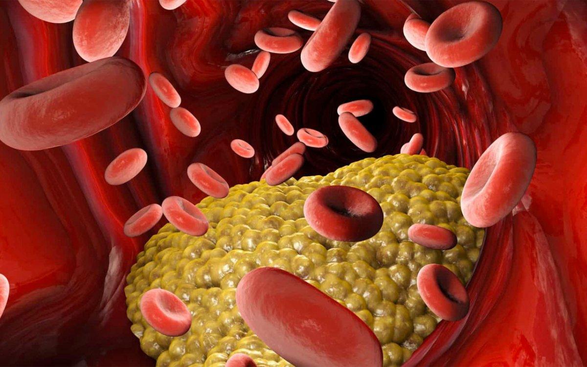 Yemeklerinize sarımsak katmanın 7 faydası