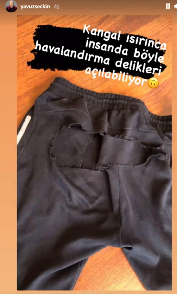 Yavuz Seçkin'i köpek ısırdı