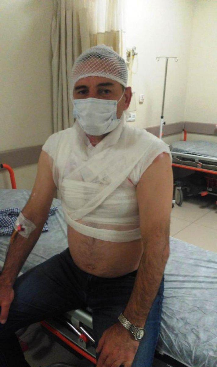 Edirne'de komşusunun üzerine kaynar su döktü