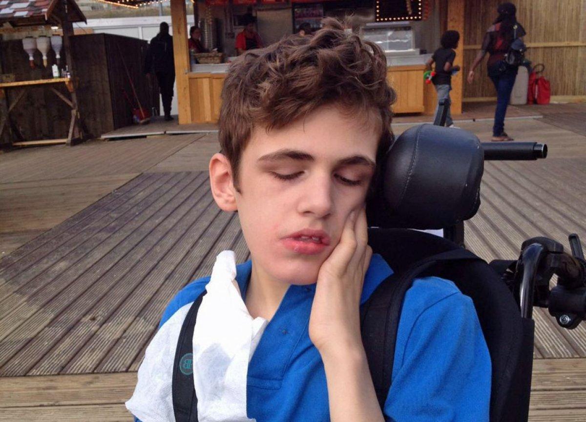 Dünyadaki en nadir hastalıklar