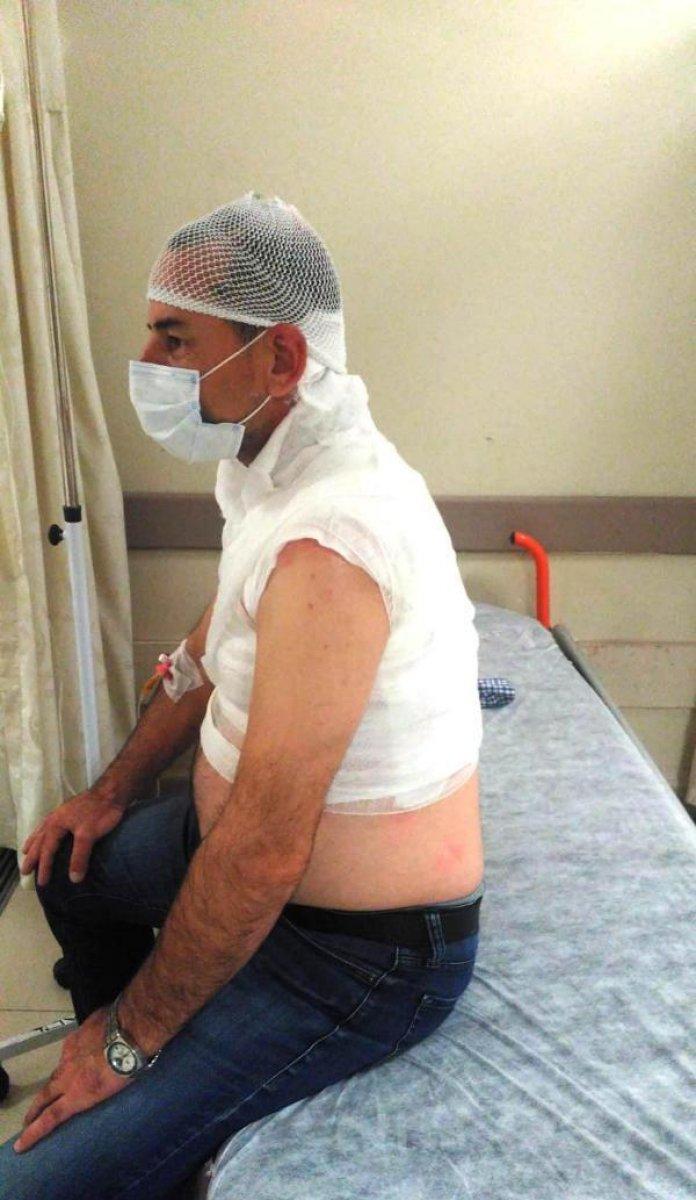 Edirne'de komşusunun üzerine kaynar su döktü