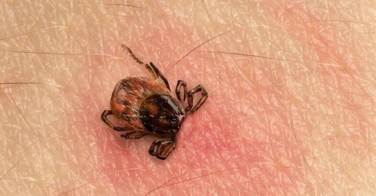 Semptomları Covid-19'la aynı: Kırım Kongo Kanamalı Ateşi belirtileri nelerdir?