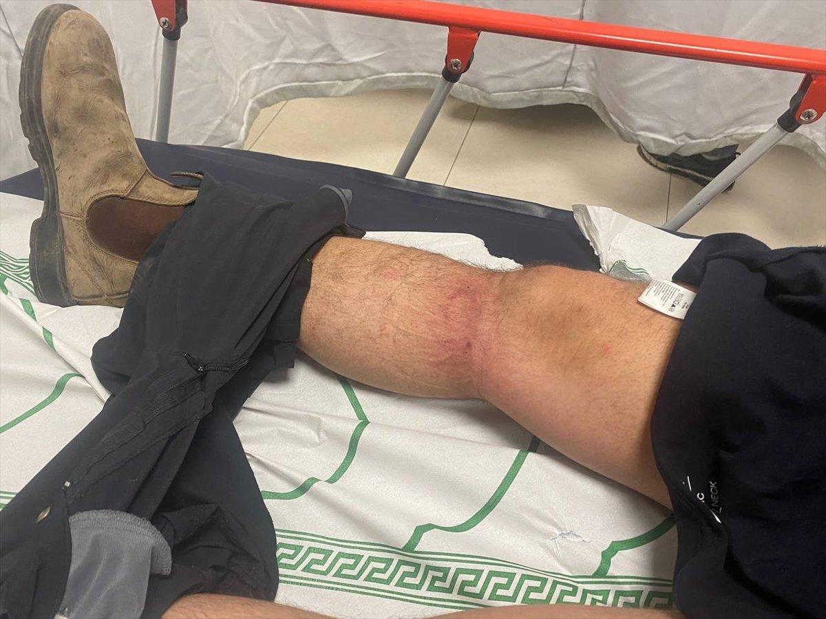 AA’nın Ortadoğu Editörü, Mescid-i Aksa saldırısında yaralandı