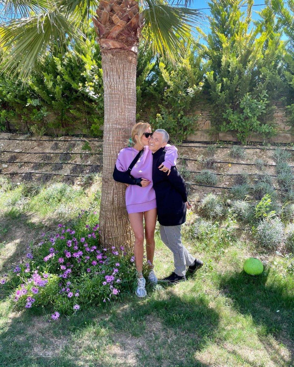 Çağla Şıkel elini kırdı