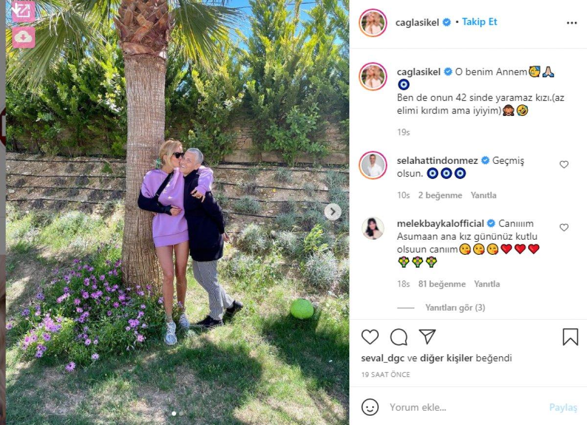 Çağla Şıkel elini kırdı