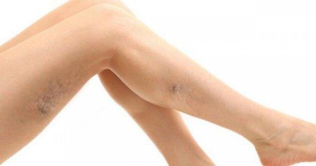 Ayak şişmesinin 6 olası nedeni