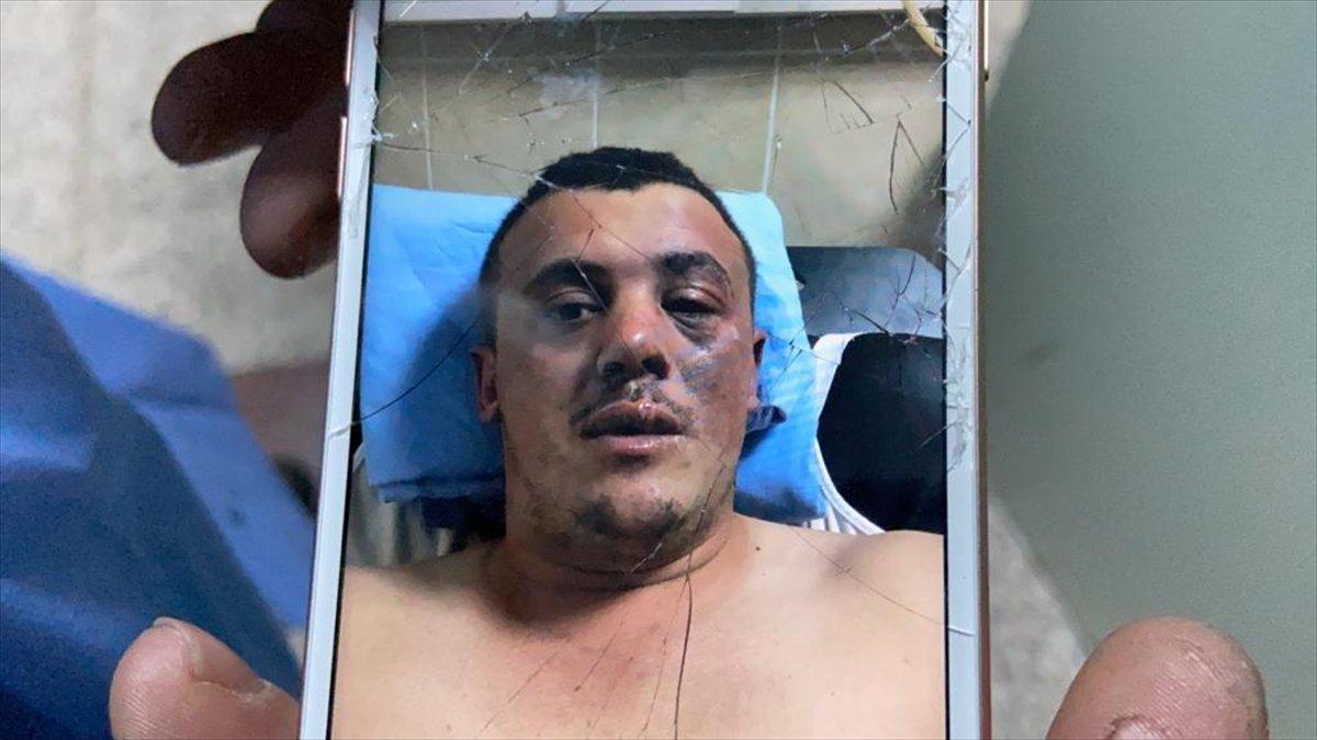 Samsun'da oksijen tüpü patladı