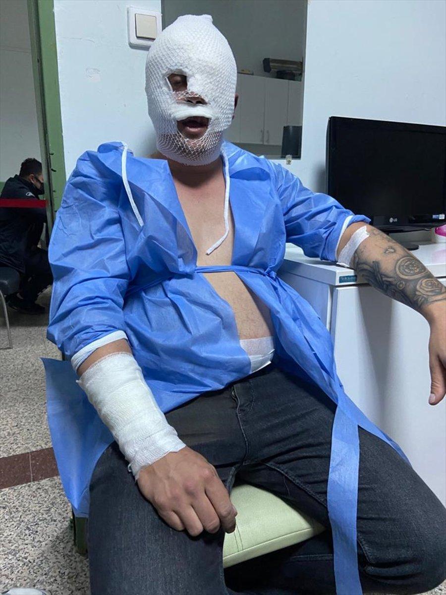 Samsun'da oksijen tüpü patladı