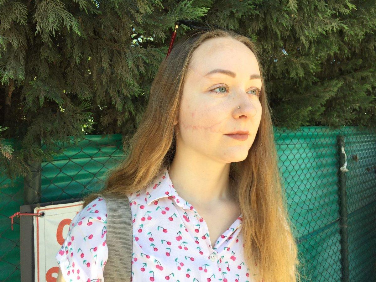 İstanbul’da eşinin falçatalı saldırısına uğradı: Yaşamak istiyorum