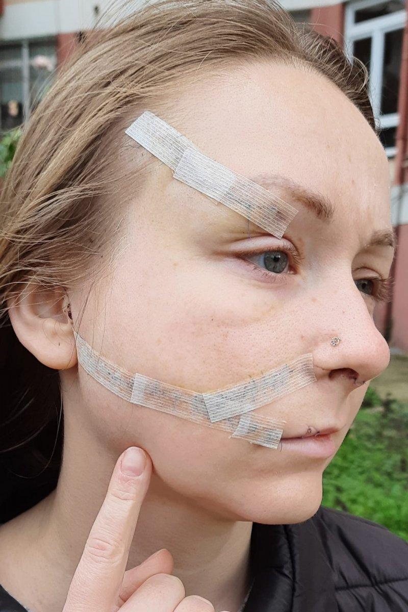 İstanbul’da eşinin falçatalı saldırısına uğradı: Yaşamak istiyorum