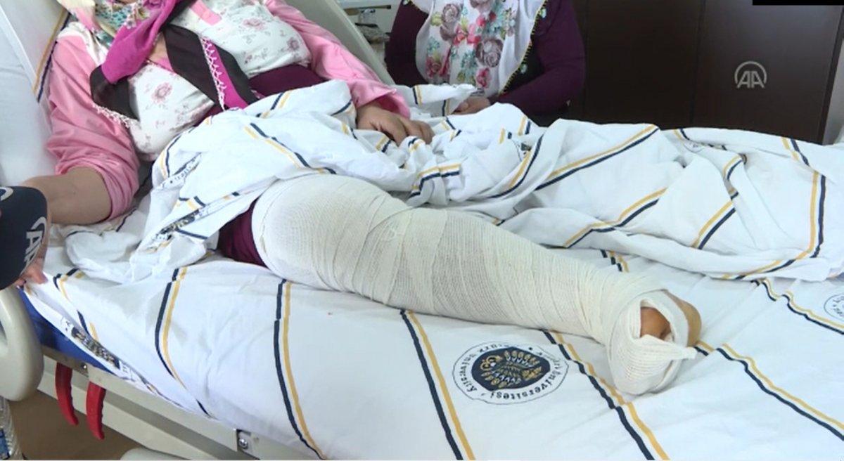 Erzurum’da varis sandığı bacağından 10 kilo tümör çıkarıldı