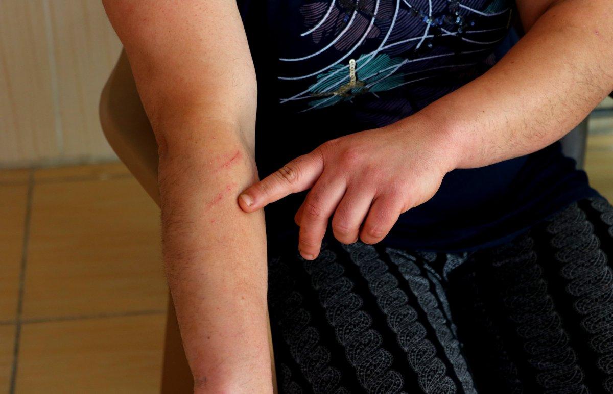 Adana’da evlat şiddetinden KADES kurtardı