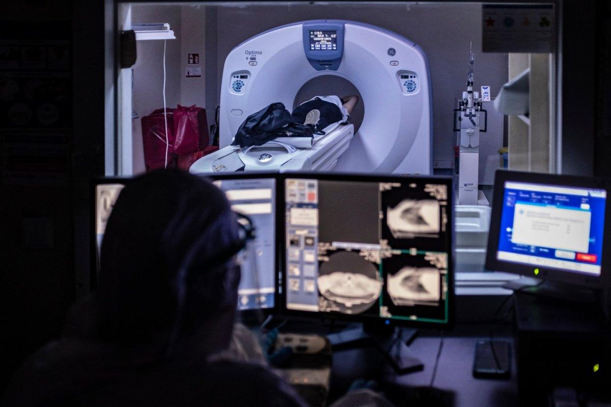 Koronavirüs sonrası nörolojik rahatsızlıklar görülebiliyor